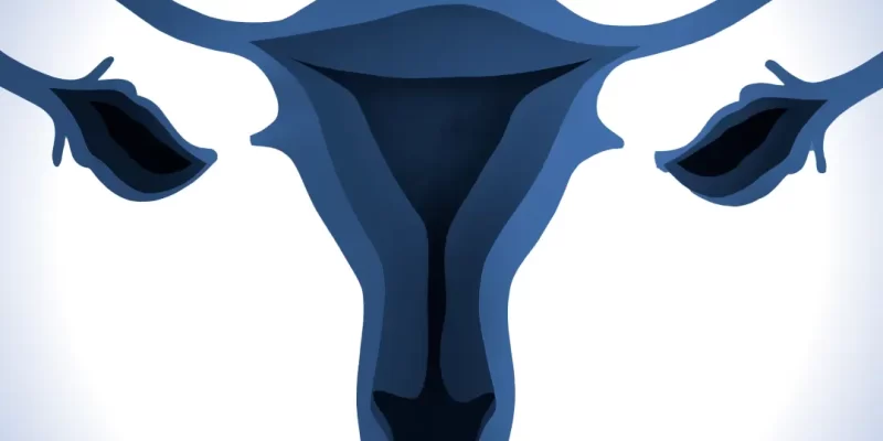 Mulheres, atenção: endometriose tem tratamento e solução
