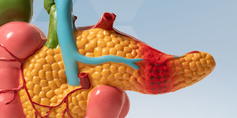 Cirurgias no pâncreas – quais os tipos, e quando é necessária